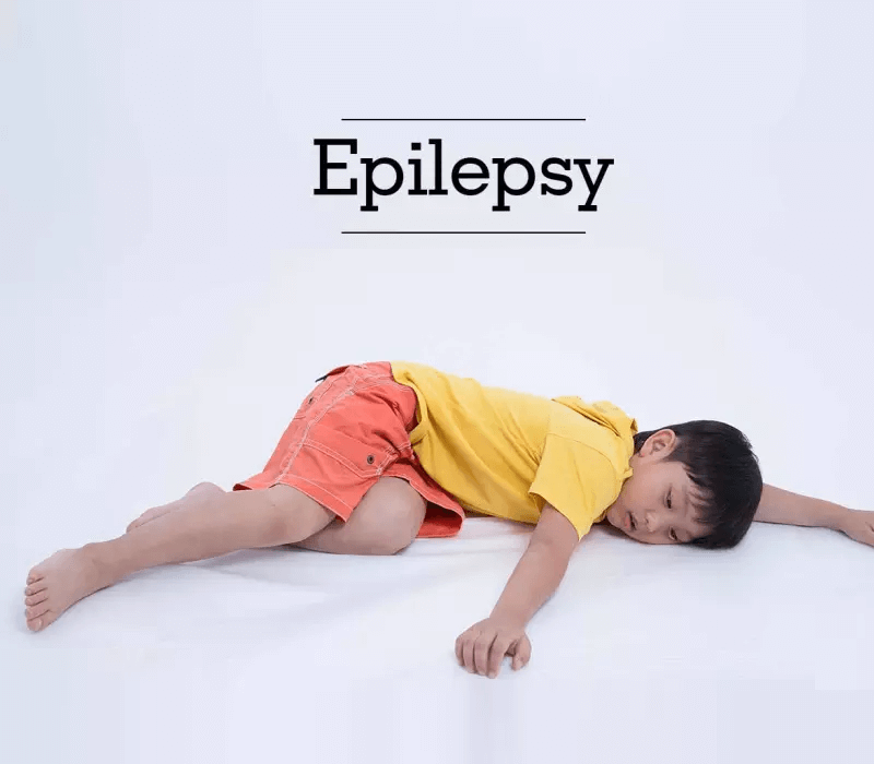 Epilepsy