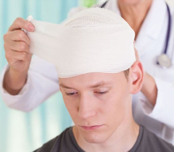 Head Injury